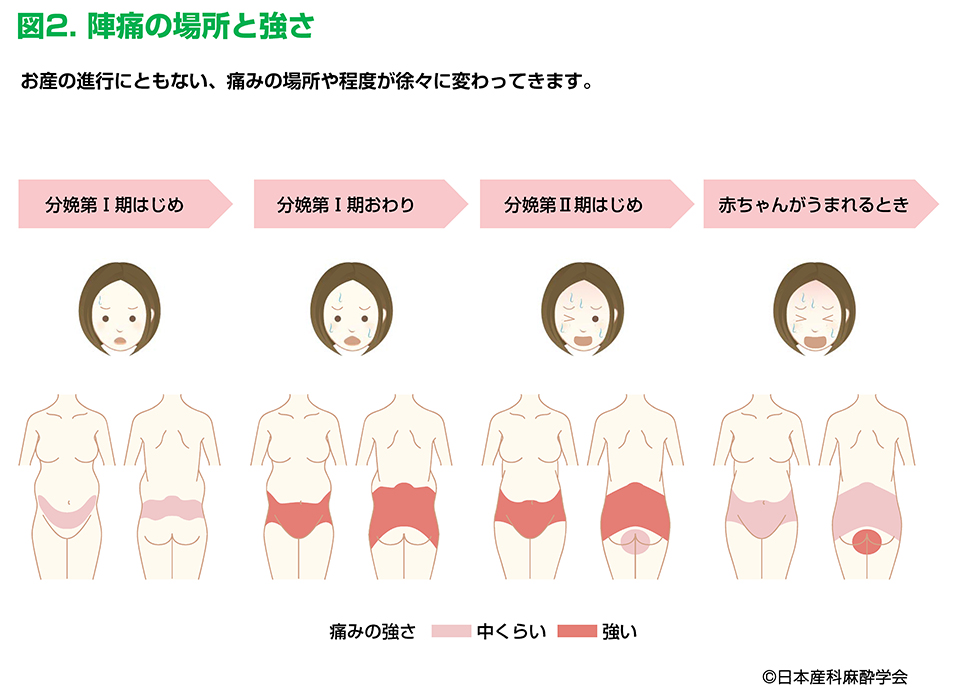 Q2 お産のときはどこが痛いのですか どのくらい痛いのですか 一般社団法人 日本産科麻酔学会